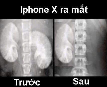 Trọn bộ siêu phẩm ảnh chế về iPhone X của cộng đồng mạng-1