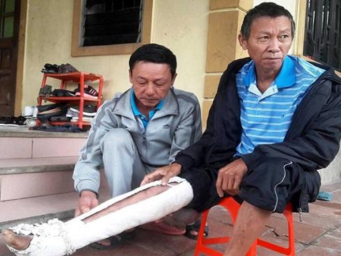 Lời khai của nghịch tử đánh bố gãy xương sườn-4