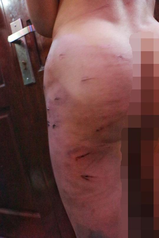 Thêm vụ tố bố đẻ bạo hành con trai bằng dây điện và dao-2