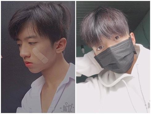 Dân mạng được phen rôm rả khi 'hot boy urgo' chuyển sang 'hot boy khẩu trang'