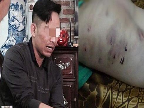 Vụ cháu trai 9 tuổi bị bạo hành bằng dây điện: Bố mẹ ký đơn hòa giải-5