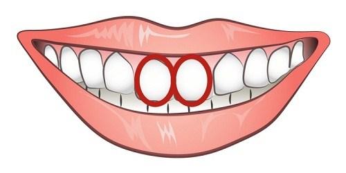 Nhìn cặp răng cửa, thấy ngay bản chất của một người-2