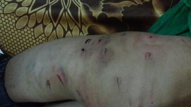 Vụ cháu trai 9 tuổi bị bạo hành bằng dây điện: Bố mẹ ký đơn hòa giải-1