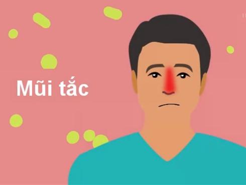 Xì mũi sai cách và những biến chứng khó lường