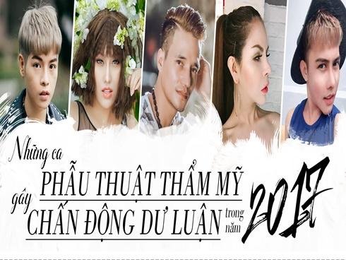 Những ca phẫu thuật thẩm mỹ gây chấn động dư luận trong năm 2017