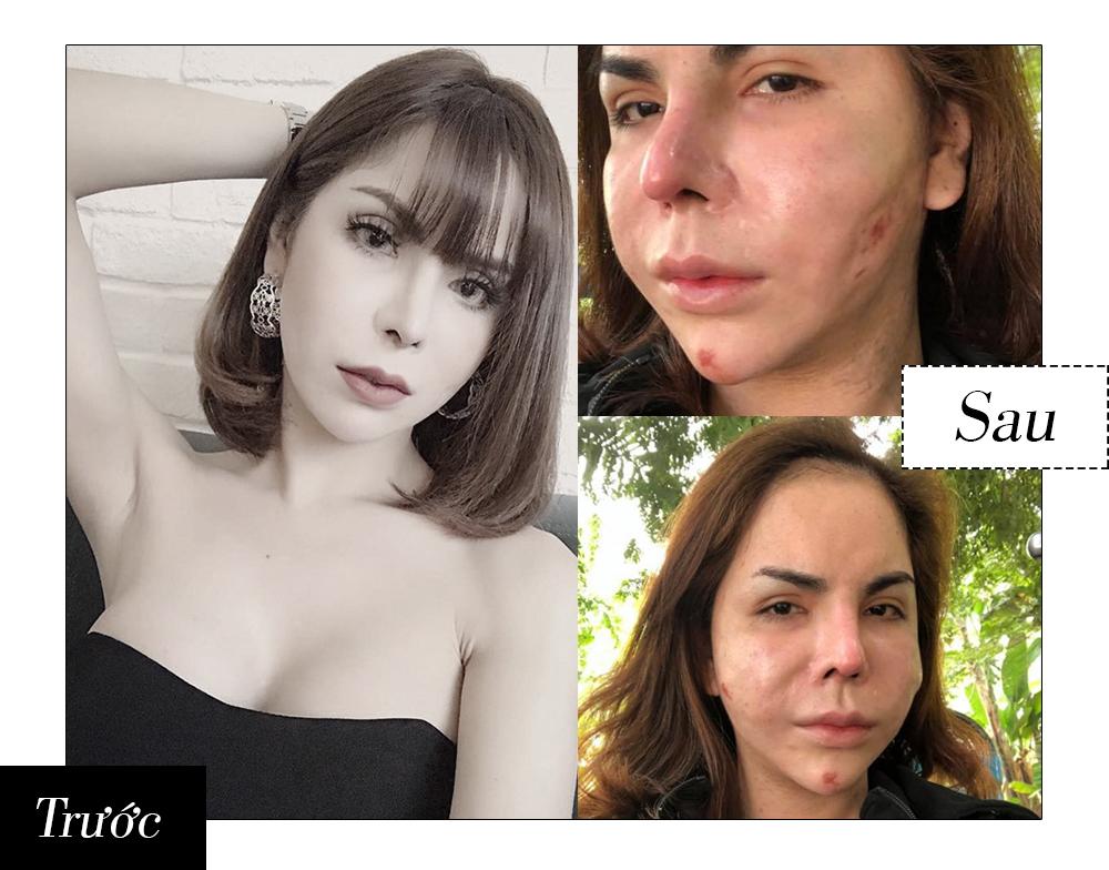 Những ca phẫu thuật thẩm mỹ gây chấn động dư luận trong năm 2017-3