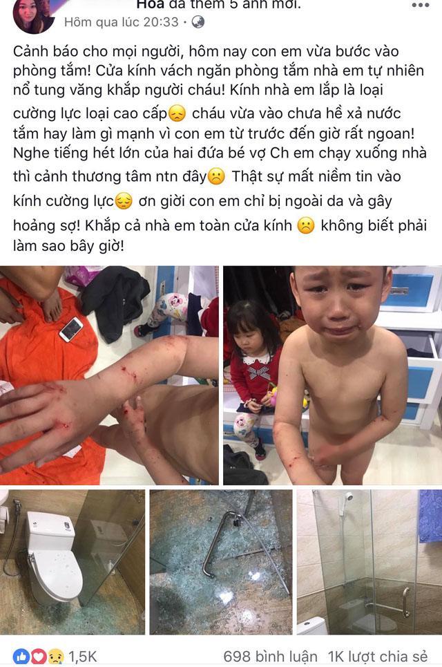 Bé trai 7 tuổi khóc thét khi kính cường lực nhà tắm bỗng dưng phát nổ-1