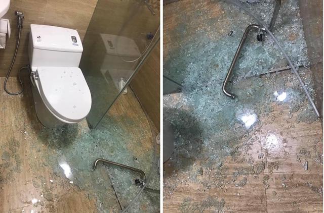 Bé trai 7 tuổi khóc thét khi kính cường lực nhà tắm bỗng dưng phát nổ-3