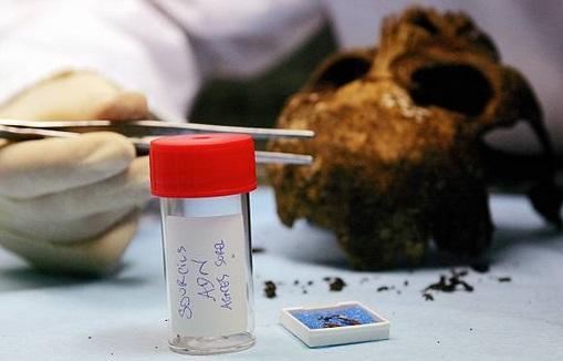 Người tình của vua Charles 7: Thích mặc váy khoe ngực, chết trẻ vì mỹ phẩm nhiễm độc chì-3