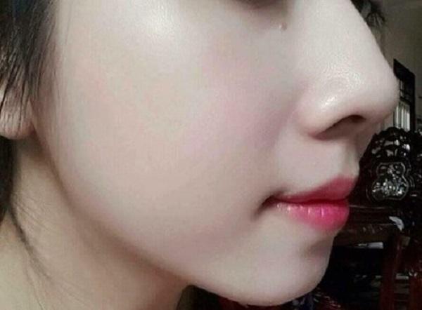 Uống thứ nước này, mụn nội tiết sạch bay chỉ sau 2 tháng, trả lại làn da láng mịn cho nàng 9X-3