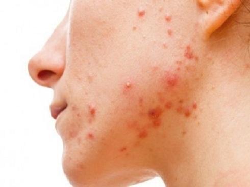 Điều gì xảy ra nếu chúng ta ngừng tắm mãi mãi?-1