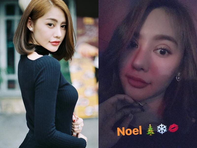 Đăng ảnh mí mắt sưng to, Linh Chi thừa nhận vừa nâng cấp cửa sổ tâm hồn-3