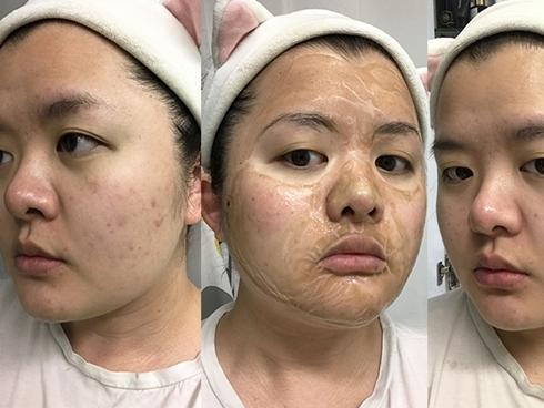 Mặt trái của ngành công nghiệp sắc đẹp Hàn Quốc: Nỗi ám ảnh vì nhan sắc và sự bất bình đẳng giới