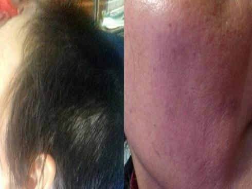 Sơn La: Bất chấp con trai 10 tuổi đứng trước mặt, chồng vẫn đánh đập và cắt trọc đầu vợ