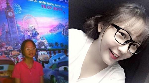 Ca ‘dậy thì’ hơn cả thành công: Cô gái đen-béo-mụn trở nên trắng trẻo, xinh đẹp đến khó tin-1