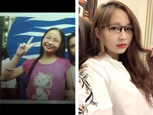 Ca ‘dậy thì’ hơn cả thành công: Cô gái đen-béo-mụn trở nên trắng trẻo, xinh đẹp đến khó tin