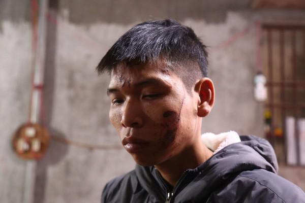 Nỗi đau ám ảnh người cha sau vụ nổ kinh hoàng cùng mưa đạn cướp mạng sống con gái 3 tuổi-5