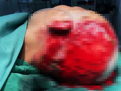 Sán làm tổ trong não gần 10 năm, người đàn ông tưởng mình bị điên-2