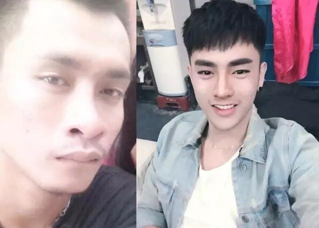 Trai quê xấu xí bỏ cả trăm triệu đồng thẩm mỹ để thành hotboy vạn người mê-1