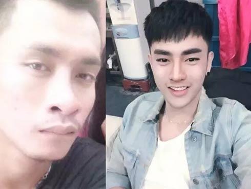 Trai 'quê' xấu xí bỏ cả trăm triệu đồng thẩm mỹ để thành hotboy 'vạn người mê'