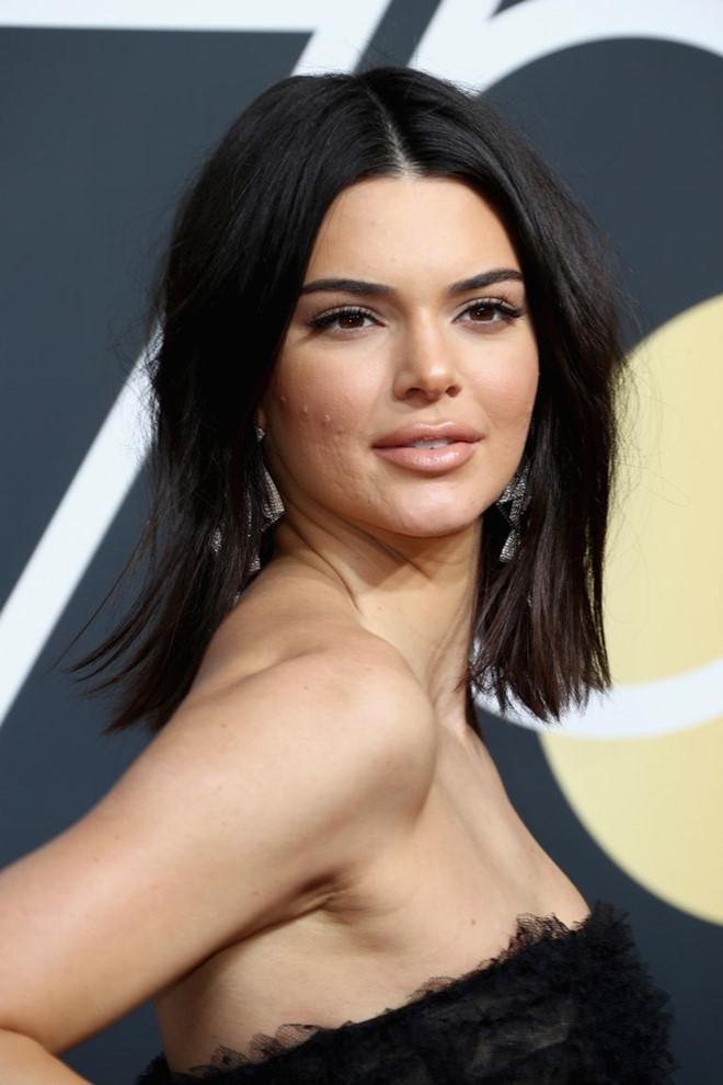 Siêu mẫu 9X Kendall Jenner bị chê mặt đầy mụn-1