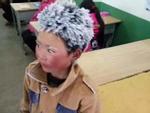 Đằng sau chuyện cậu bé Trung Quốc bị đóng băng toàn bộ tóc vì giá rét