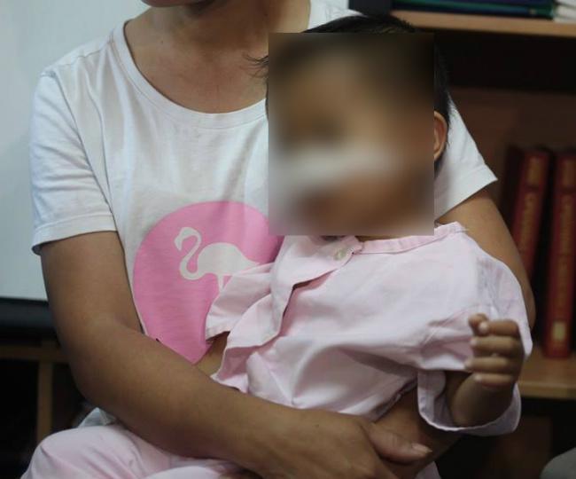 Xót xa bé 3 tuổi bị chó nhà cắn xé dữ dội khi chơi đùa, mất mũi và rách mặt-1