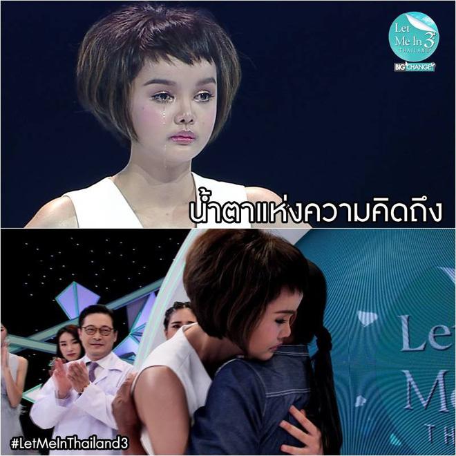 Không quá xấu xí, cô gái 20 tuổi vẫn quyết phẫu thuật thẩm mỹ và cái kết gây tranh cãi-2