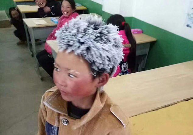 Cậu bé tóc đóng băng ở Trung Quốc được hỗ trợ hàng triệu USD-1