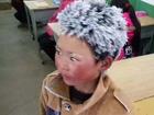Cậu bé tóc đóng băng ở Trung Quốc được hỗ trợ hàng triệu USD