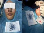 ẢNH HOT trong tuần: Kinh dị bác sĩ gắp hàng trăm sợi chỉ nilon trong 'mũi giả' một phụ nữ Hà Nội