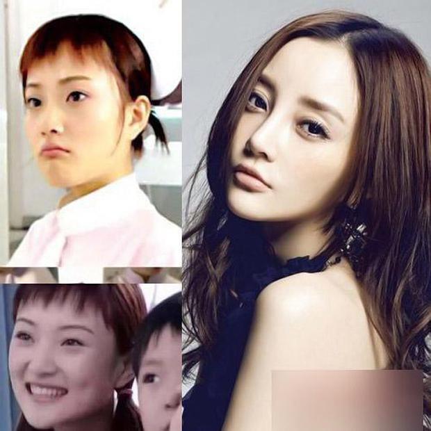 Chuyện ngoại tình chưa lắng, dân mạng soi đến gương mặt lạm dụng dao kéo của vợ Giả Nãi Lượng-1