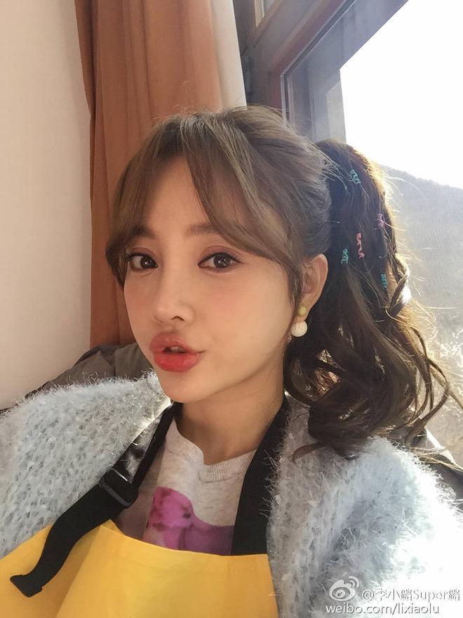 Chuyện ngoại tình chưa lắng, dân mạng soi đến gương mặt lạm dụng dao kéo của vợ Giả Nãi Lượng-11