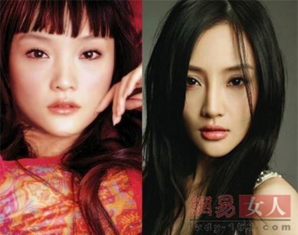 Chuyện ngoại tình chưa lắng, dân mạng soi đến gương mặt lạm dụng dao kéo của vợ Giả Nãi Lượng-3