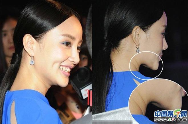 Chuyện ngoại tình chưa lắng, dân mạng soi đến gương mặt lạm dụng dao kéo của vợ Giả Nãi Lượng-8