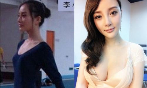 Lý Tiểu Lộ bị yêu cầu rút khỏi showbiz vì lộ dấu hiệu thẩm mỹ-1