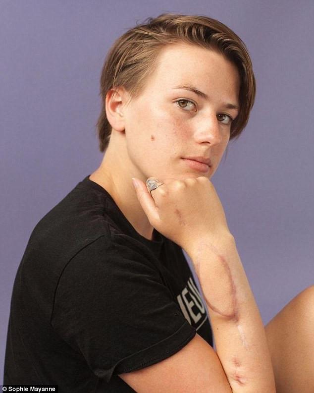 10 cô gái dũng cảm và câu chuyện vết sẹo đi theo cả cuộc đời-6