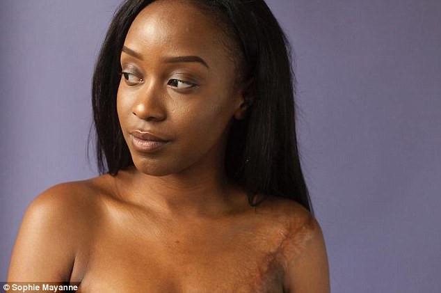 10 cô gái dũng cảm và câu chuyện vết sẹo đi theo cả cuộc đời-7