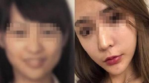 Gọt cằm quá đà, cô gái khóc ròng không thể về quê vì quá khác với ảnh hộ chiếu-1