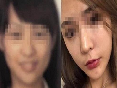 Gọt cằm quá đà, cô gái khóc ròng không thể về quê vì quá khác với ảnh hộ chiếu