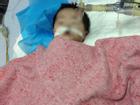 Công bố nguyên nhân bé 8 tháng tuổi ở Hà Nội nguy kịch sau tiêm thuốc