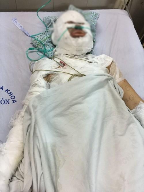 Vụ cô gái bị người đàn ông ngoại quốc tẩm xăng đốt: ‘Con chưa bao giờ kể tôi nghe về người này’-3
