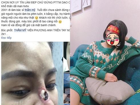 KHIẾP SỢ: Mũi thủng lỗ khổng lồ chỉ vì dùng thuốc mỡ sai cách-6