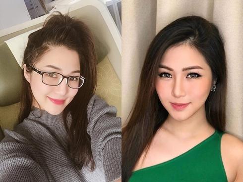 Hương Tràm đi lại phải có người dìu, gần như mất thị giác