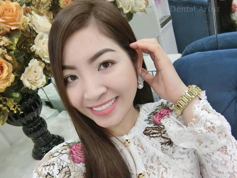 Không cần đến nha sĩ, 6 mẹo làm trắng răng tức khắc-7