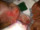 Bé trai 15 tháng tử vong ở Thanh Hóa: Bệnh viện lên tiếng về thông tin trên mạng xã hội