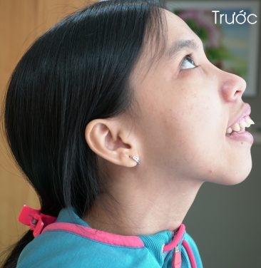 Hành trình kiếm tìm sắc đẹp của cô gái sống thiếu tình thương cha mẹ-1