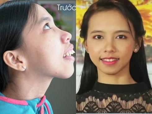 Cô gái suýt bị đuổi việc vì có đôi mắt kém xinh-4