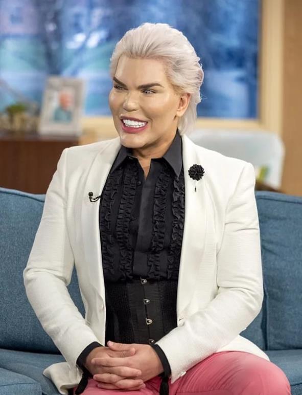 Búp bê Ken gây shock khi khoe 4 chiếc xương sườn vừa cắt bỏ để có vòng eo 51 cm-1