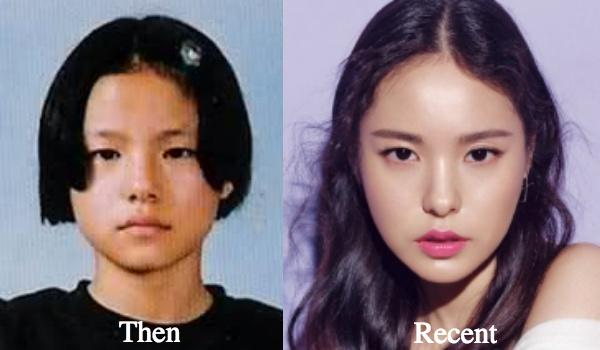 Sao Hàn 7/2: Bà xã Big Bang Taeyang gây chú ý với bức ảnh trước khi phẫu thuật thẩm mỹ-1